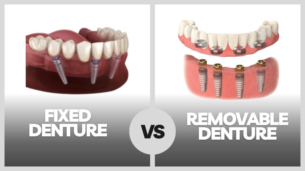 Dentures