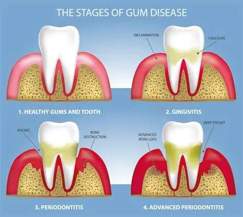 Gum Treatment